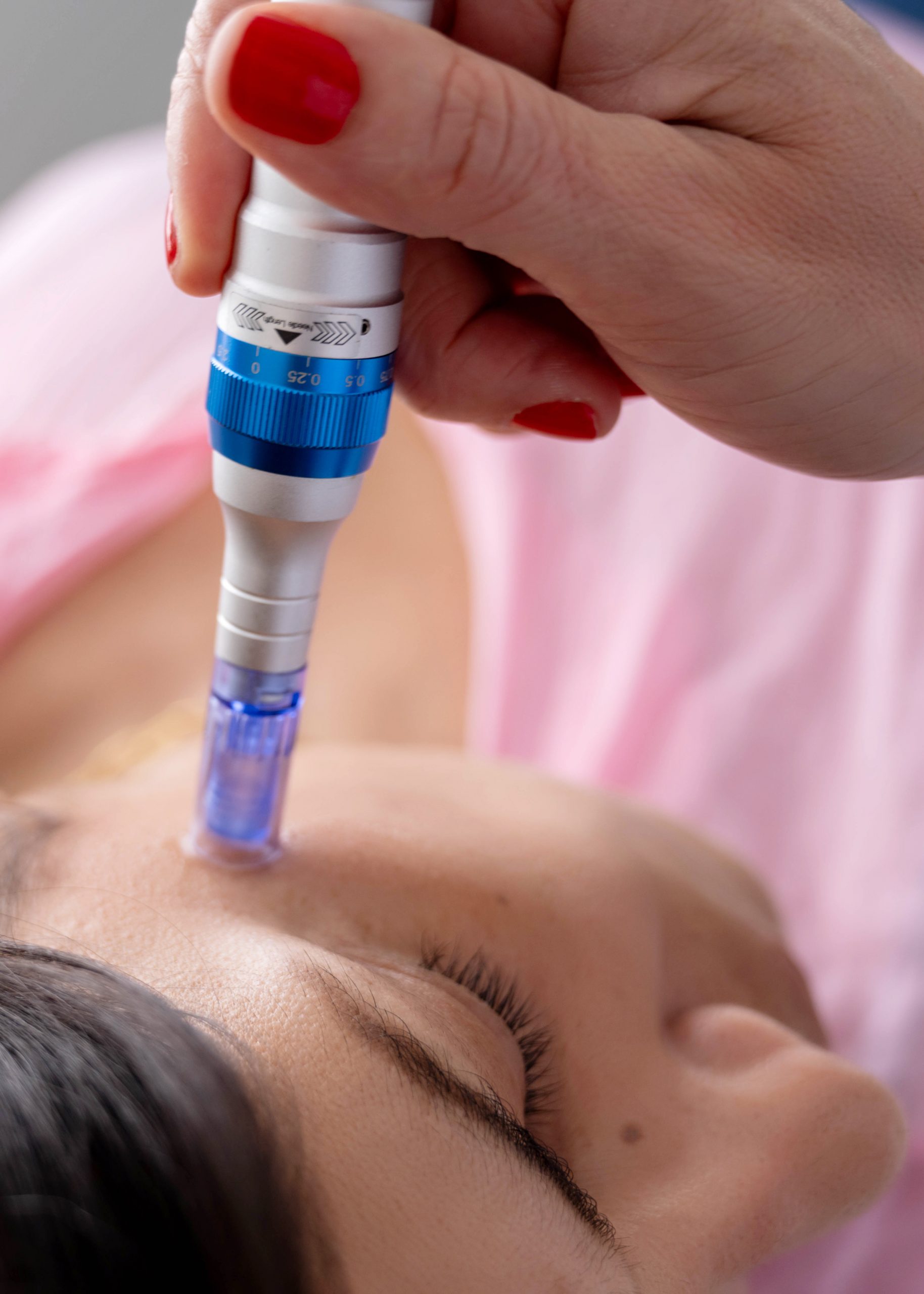 Microneedling visage